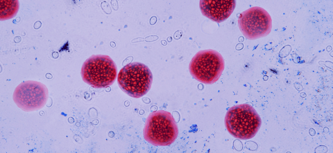 Cyclospora parasite up close.